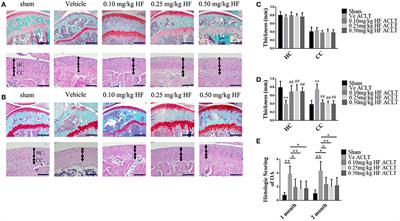 Halofuginone Attenuates Osteoarthritis by Rescuing Bone Remodeling in Subchondral Bone Through Oral Gavage